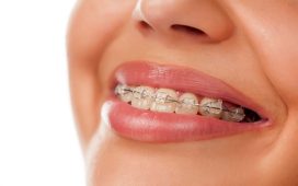 Orthodontic Solutions in Calgary