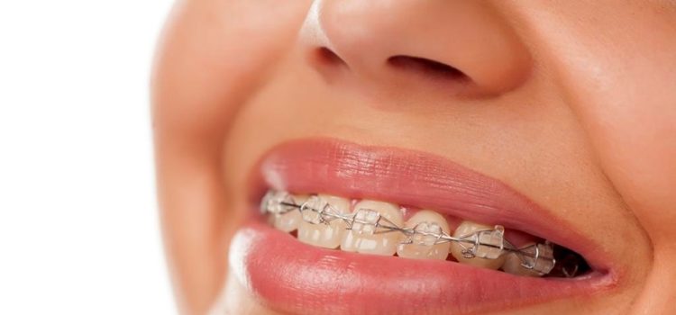Orthodontic Solutions in Calgary